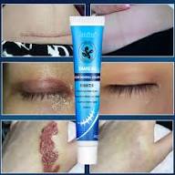 Snake Oil Scar Removal Cream