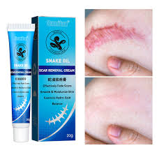 Snake Oil Scar Removal Cream